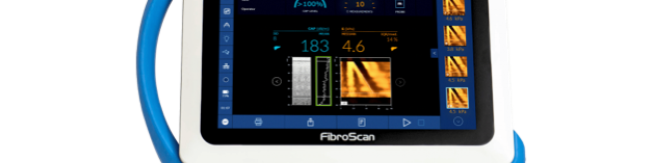 Fibroscan