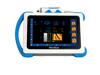 Fibroscan