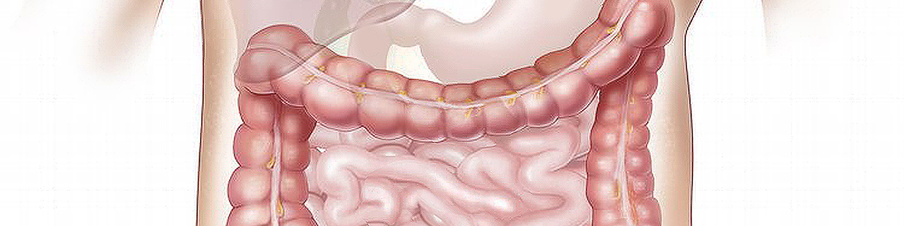 Morbus Crohn & Colitis ulcerosa